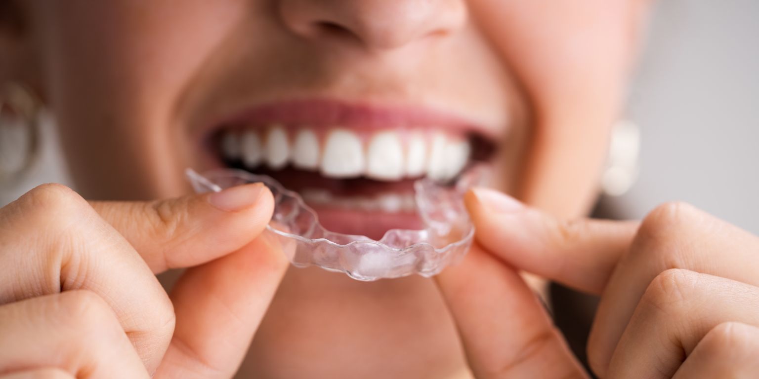 Studio dentistico Conti a Firenze: il bite dentale, un rimedio poco invasivo e molto efficace.